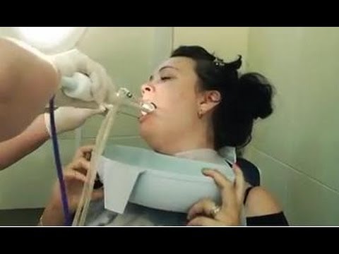 Как убрать миндалины в домашних условиях Как убрать миндалины в домашних условиях
