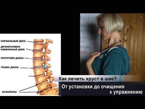Вывих голеностопного сустава: первая помощь Вывих голеностопа - 10 методов диагностики и
